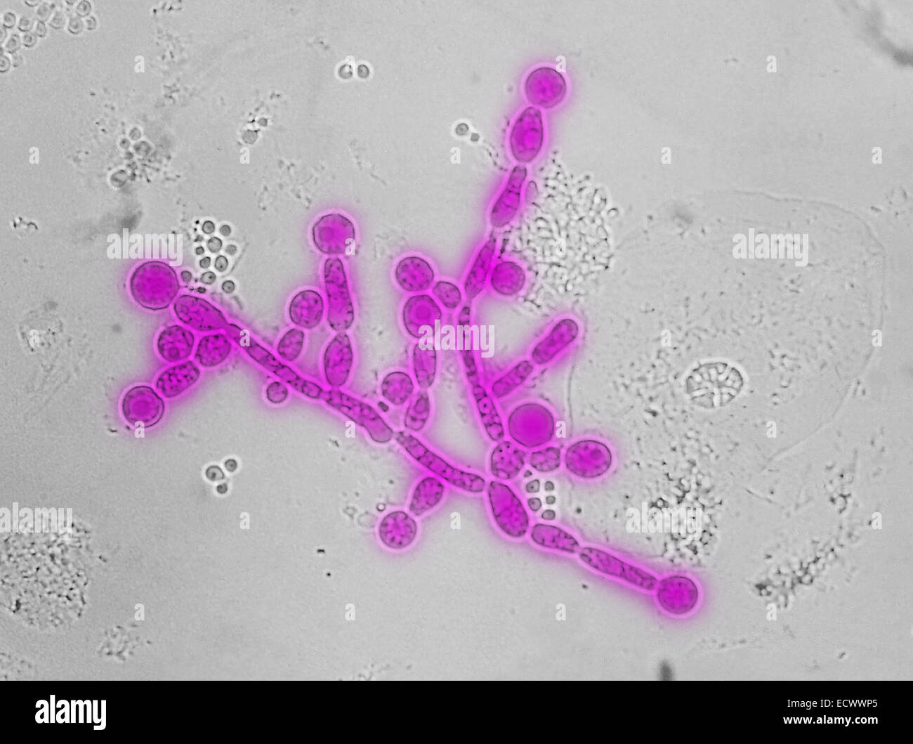 Micrographe de Candida de chlamydospores Photo Stock - Alamy