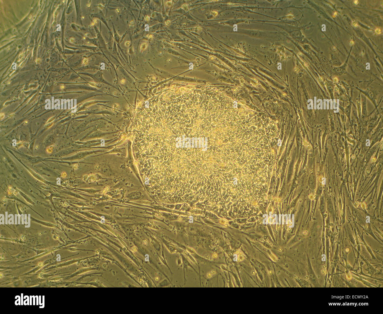 Colonie de cellules souches embryonnaires humaines. Banque D'Images