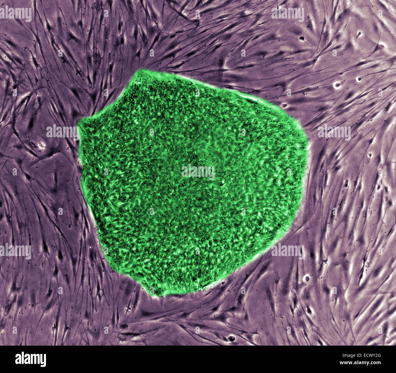 Colonie de cellules souches embryonnaires humaines. Banque D'Images