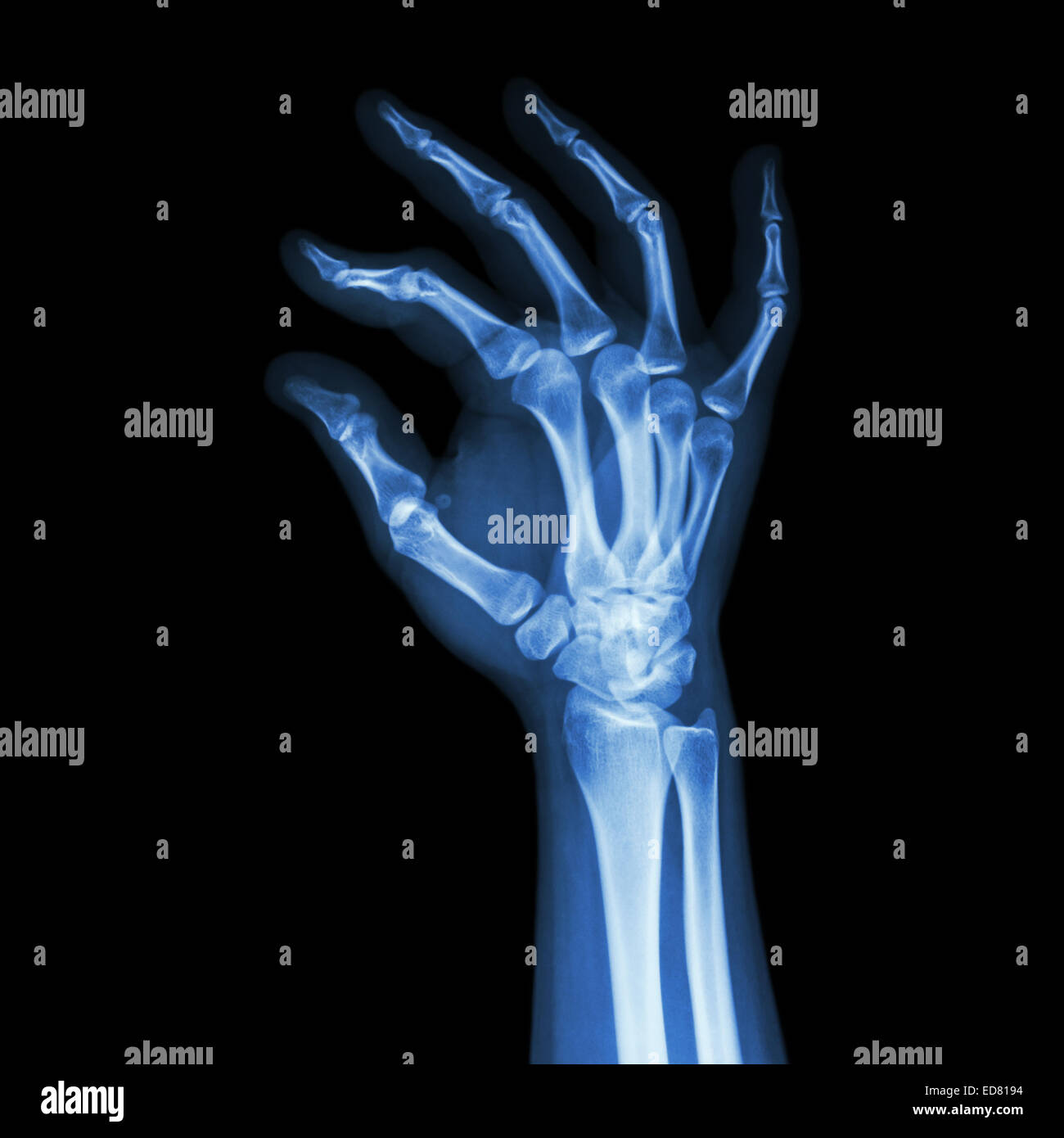 Film x-ray la main de l'homme et symbole OK Banque D'Images
