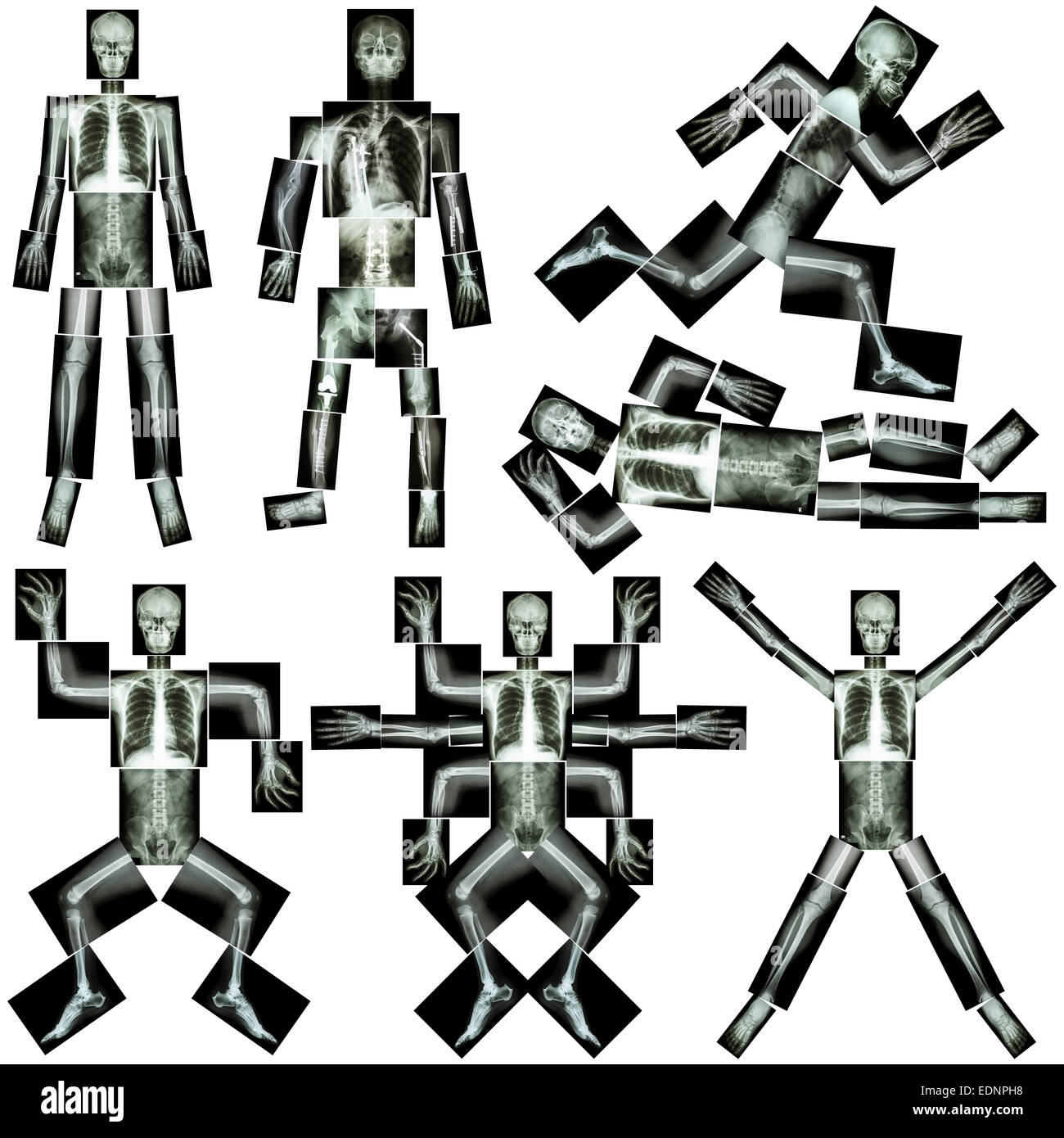 Collection de squelette humain (X-ray corps entier : crâne face dos cou épaule coude poignet du bras avant-bras main doigt thorax Banque D'Images