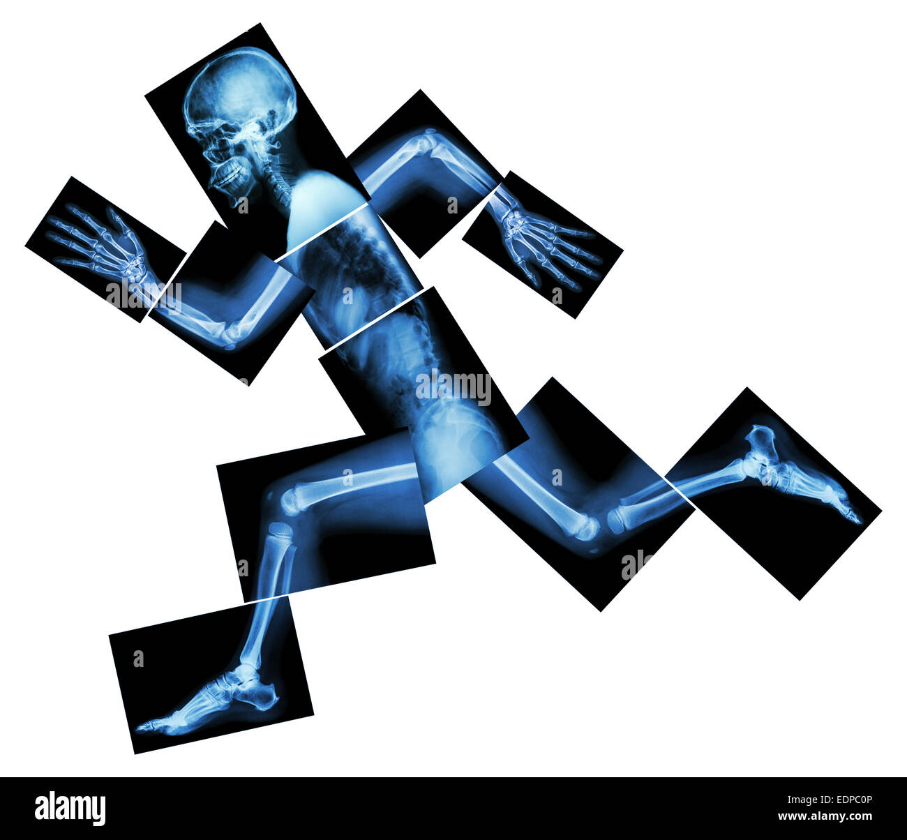 Marathon (les droits de l'os est en marche) ,(corps entier x-ray : tête, cou, bras, épaule, coude, avant-bras, main, doigt ,,commune thorax ,ab Banque D'Images
