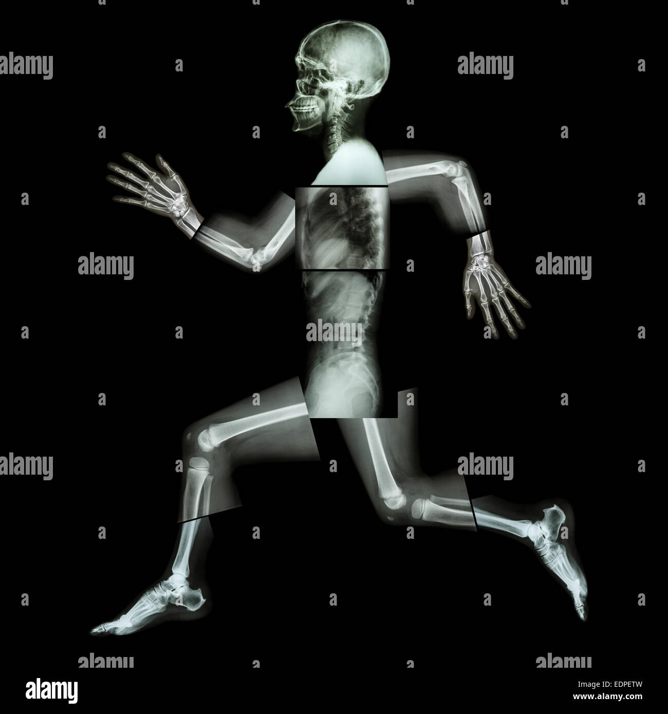 L'exercice aérobie (droits de l'os est en marche) ,(corps entier x-ray : tête, cou, épaule, bras, épaule, coude, avant-bras, main, doigt Banque D'Images