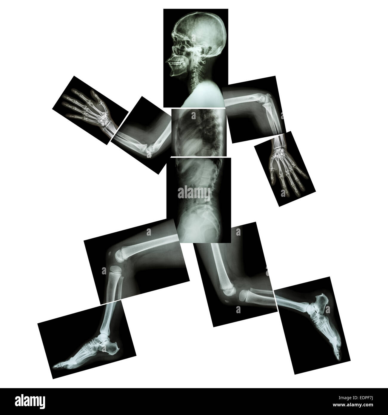 L'exercice aérobie (droits de l'os est en marche) ,(corps entier x-ray : tête, cou, épaule, bras, épaule, coude, avant-bras, main, doigt Banque D'Images