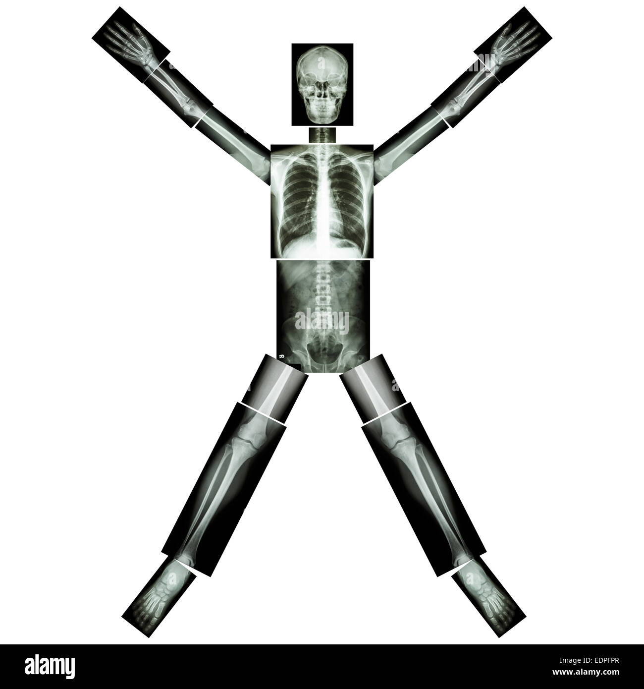 Les os humains s'étire bras et jambes (ensemble du corps : la tête cou poitrine abdomen dos dos épaule coude poignet du bras avant-bras main pulmonaire Banque D'Images