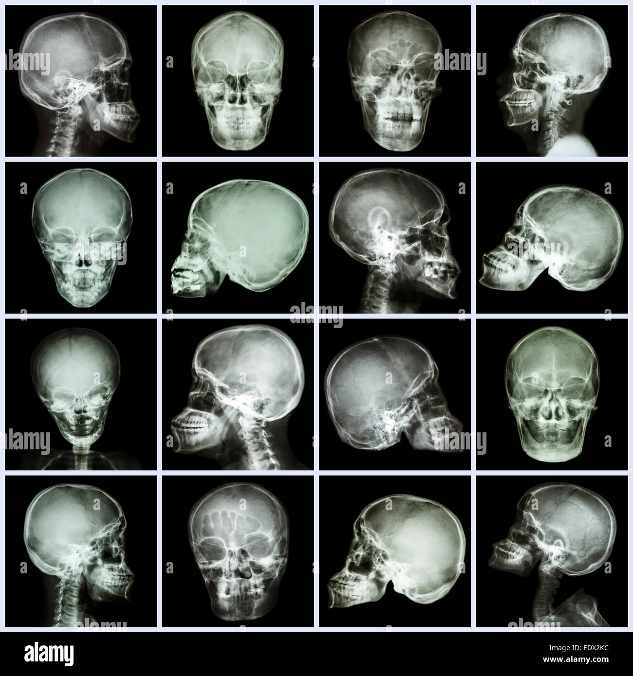 Collection x-ray crâne (peuples asiatiques) Banque D'Images