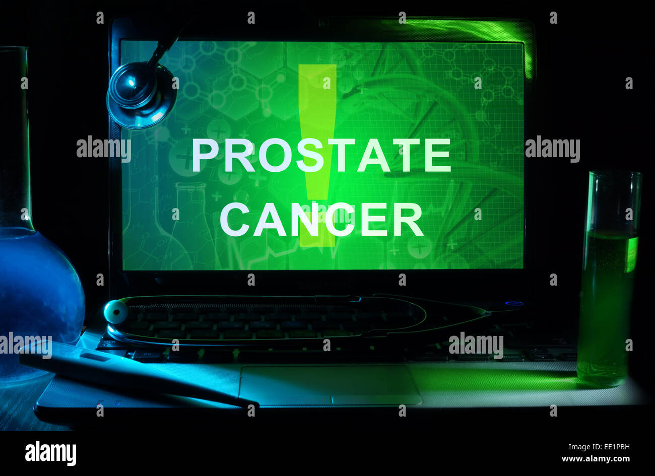 Ordinateur portable avec des mots le cancer de la prostate, tubes à essai et stéthoscope Banque D'Images