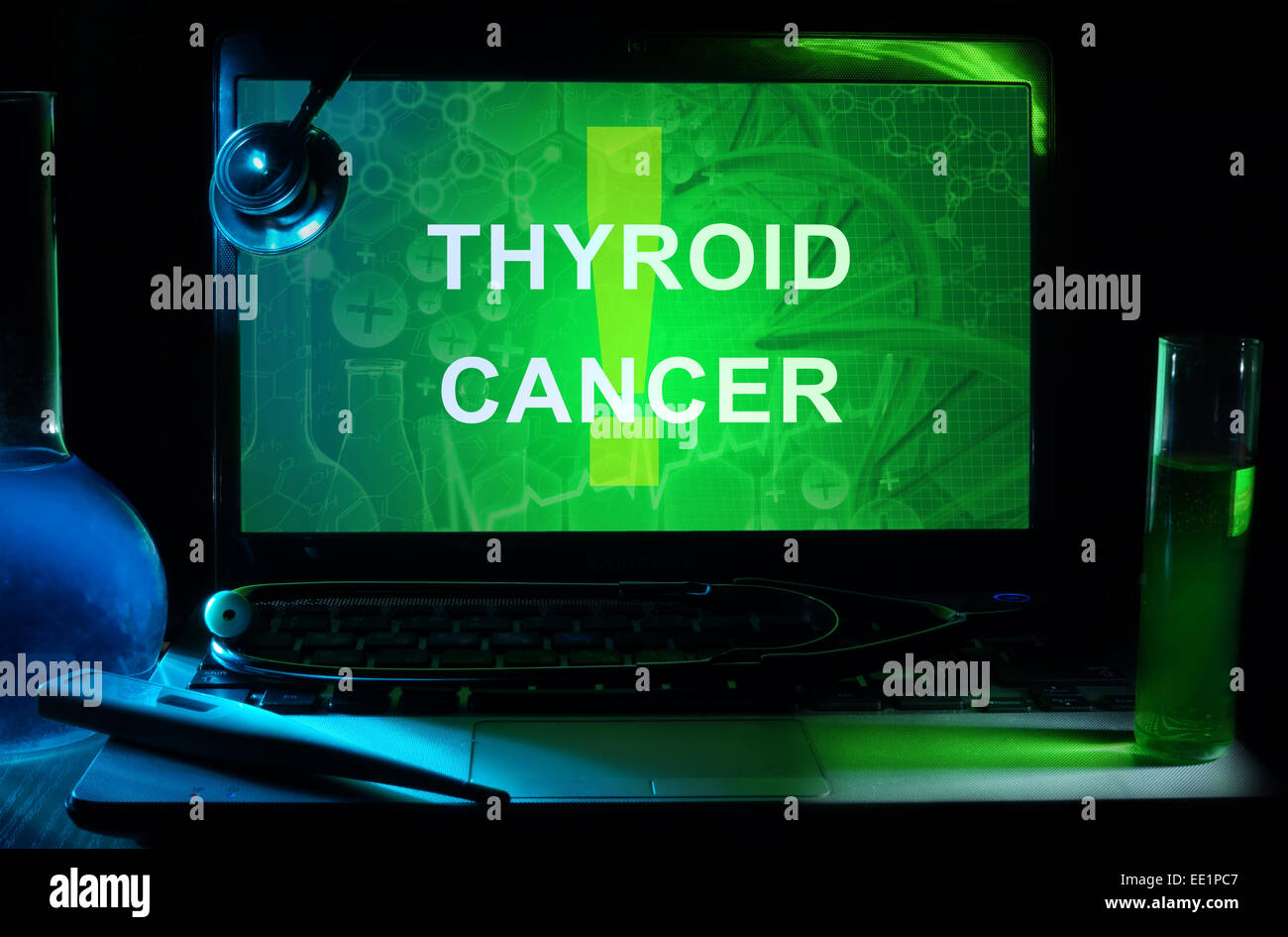 Ordinateur portable avec des mots le cancer de la thyroïde, tubes à essai et stéthoscope Banque D'Images