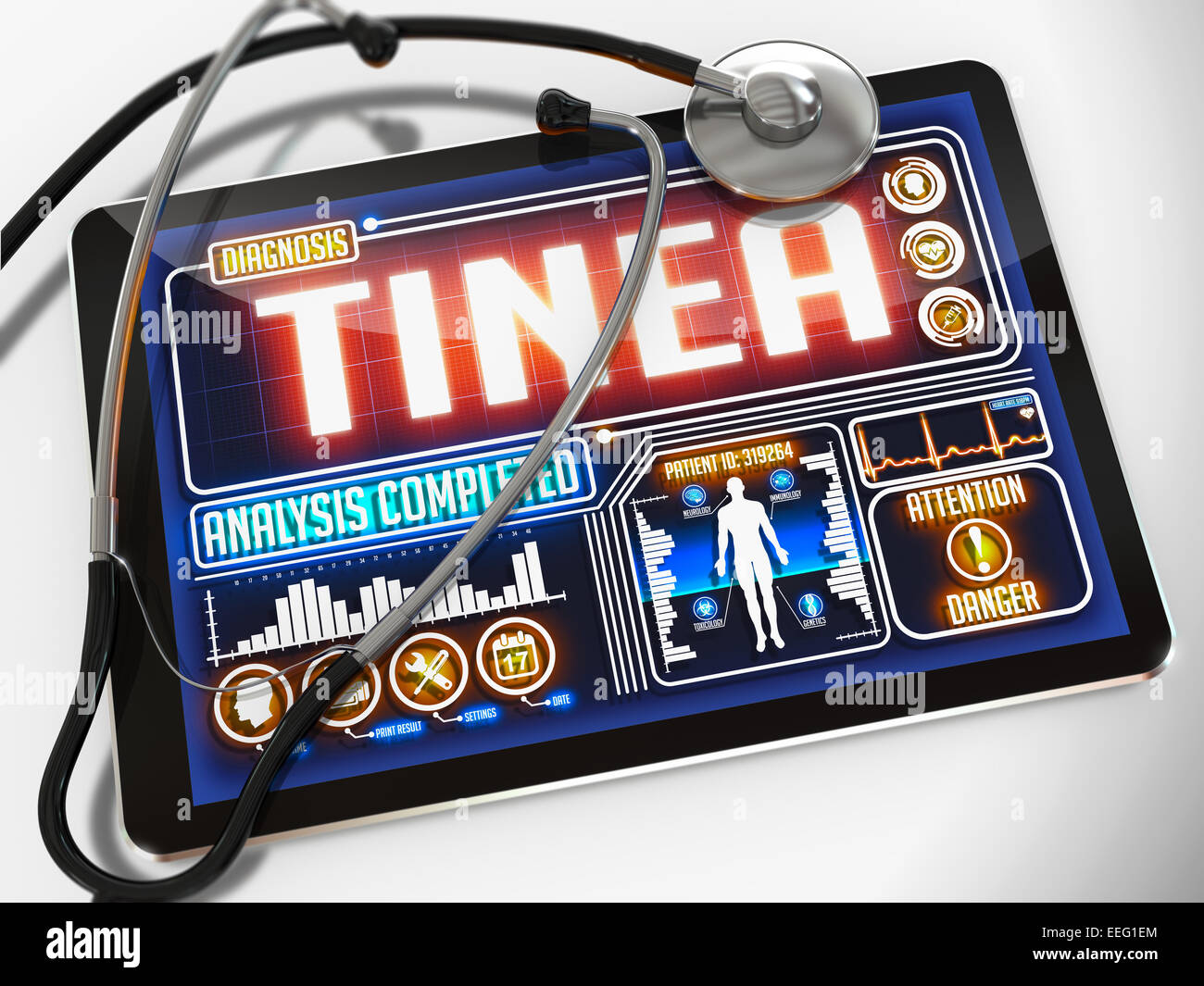 Tinea sur l'affichage de la tablette médicale. Banque D'Images Tinea sur l'affichage de la tablette médicale. Banque D'Images