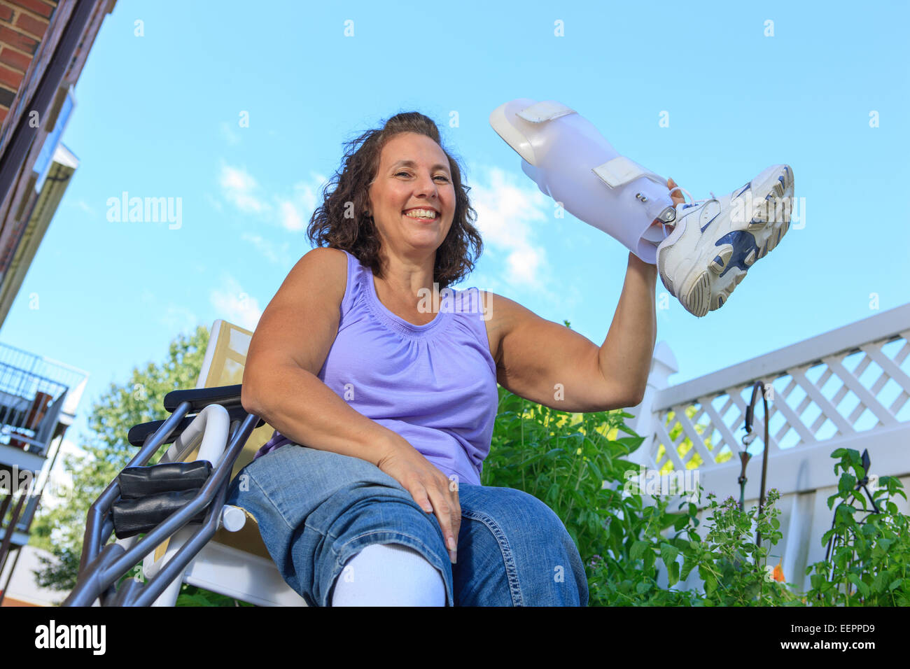 Femme avec le spina-bifida montrant outre de nouveau renfort de jambe Banque D'Images