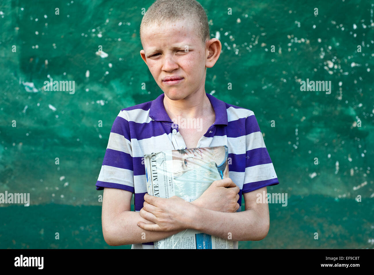 Albino boy holding son manuel (Éthiopie) Banque D'Images