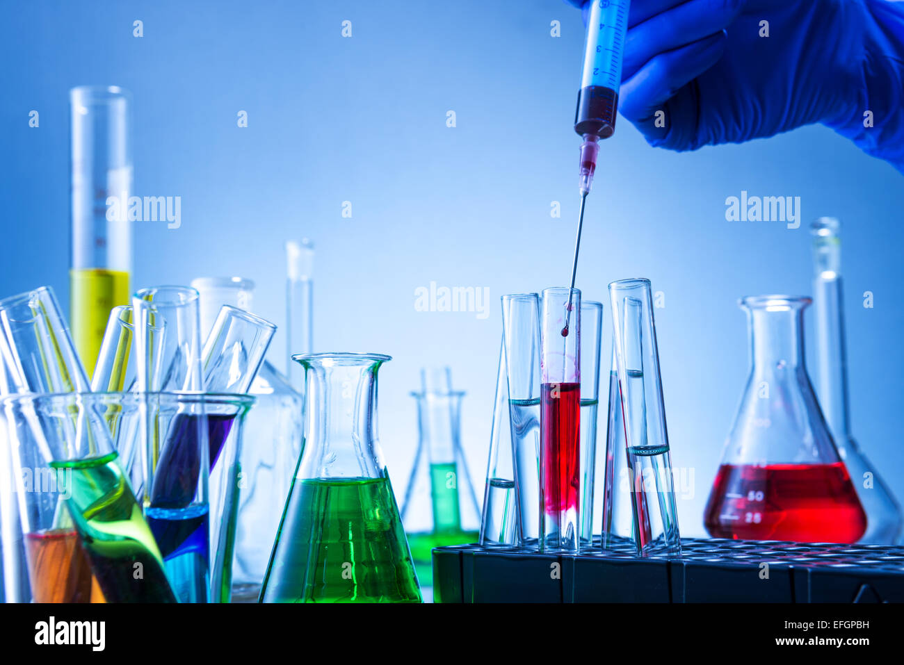 L'équipement de laboratoire, beaucoup de verre remplis de liquides colorés et d'injection à la main Banque D'Images