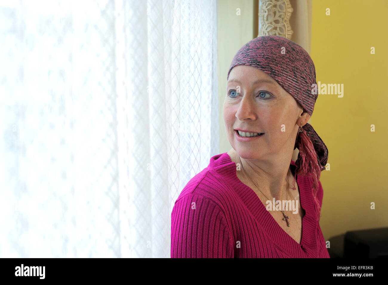Nicolle Amiri durant la chimiothérapie traitement pour la leucémie. Banque D'Images