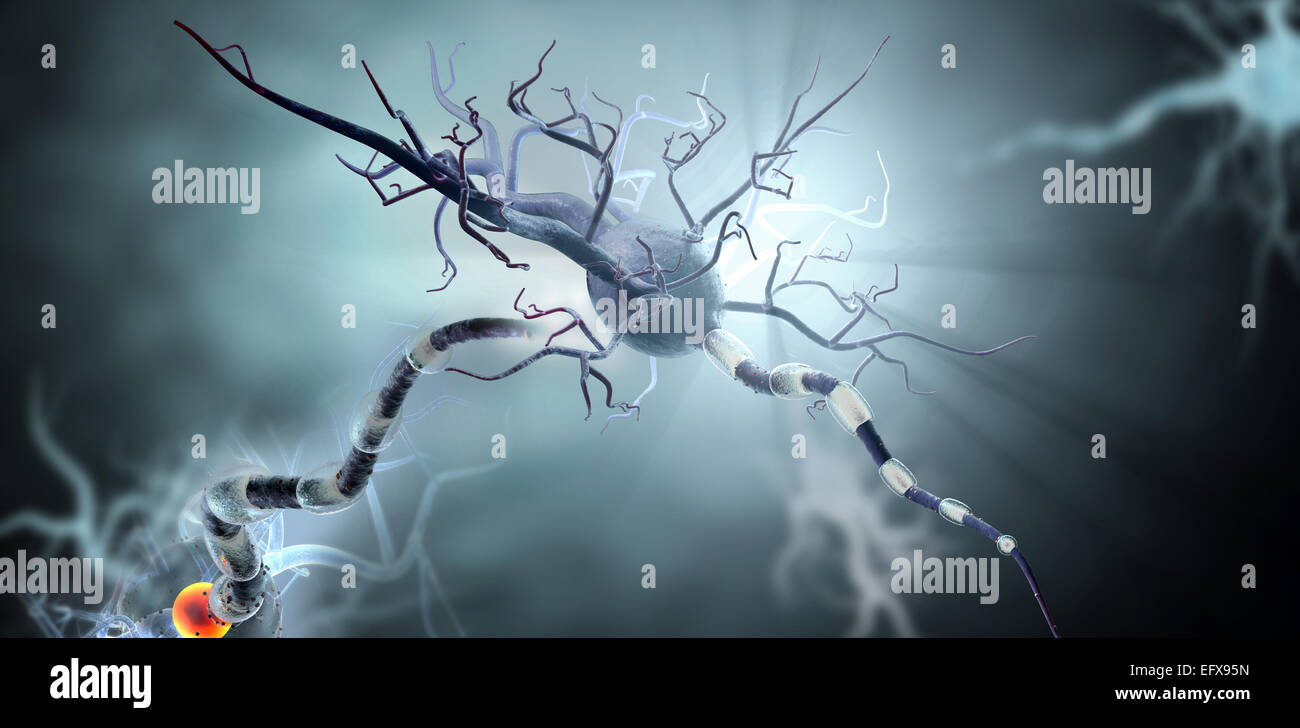 Les cellules nerveuses, concept pour les tumeurs, les maladies neurologiques et une chirurgie du cerveau. Banque D'Images