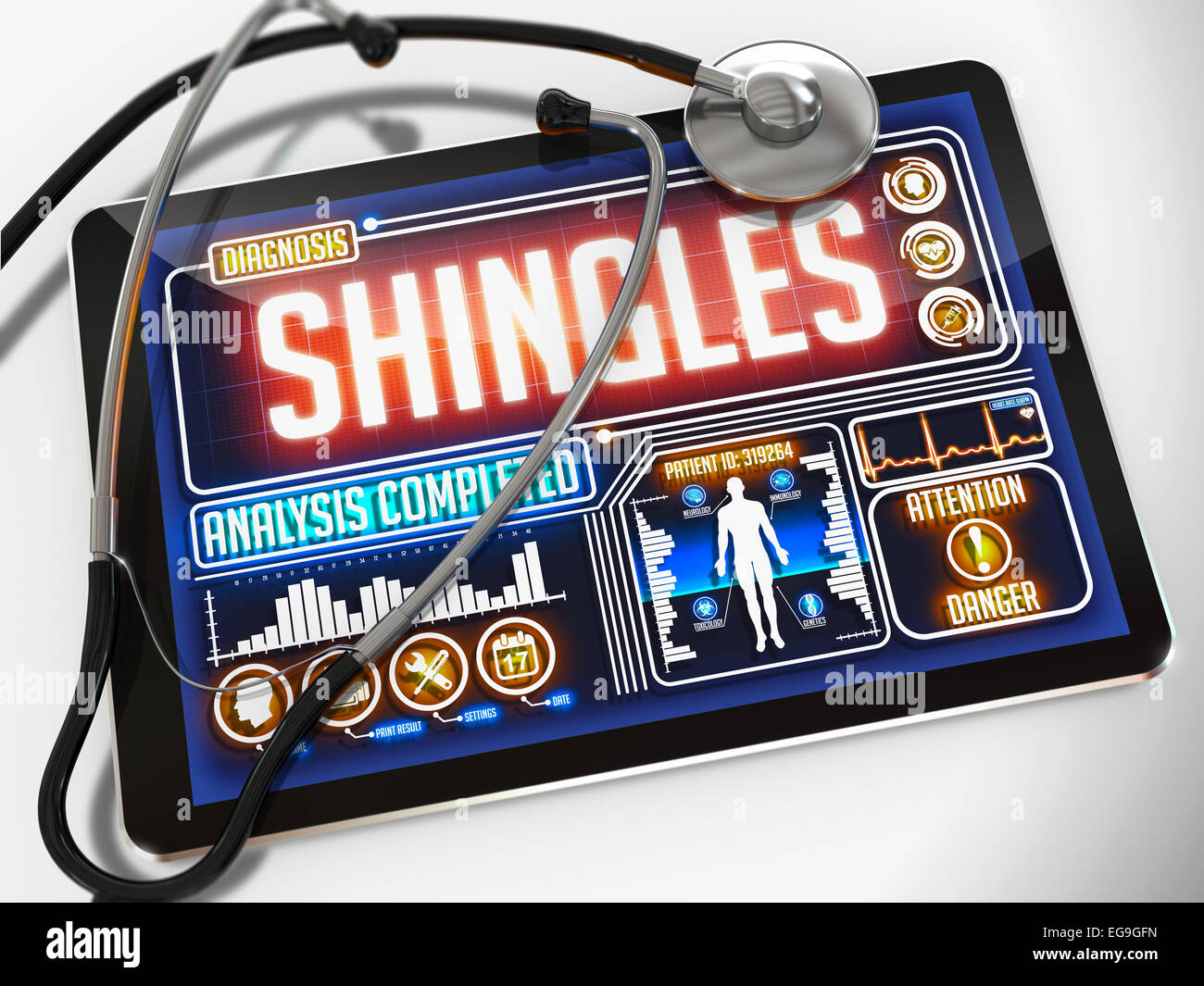 Tablette médicale avec le diagnostic de ZONA sur l'écran et d'un stéthoscope noir sur fond blanc. Banque D'Images Tablette médicale avec le diagnostic de ZONA sur l'écran et d'un stéthoscope noir sur fond blanc. Banque D'Images