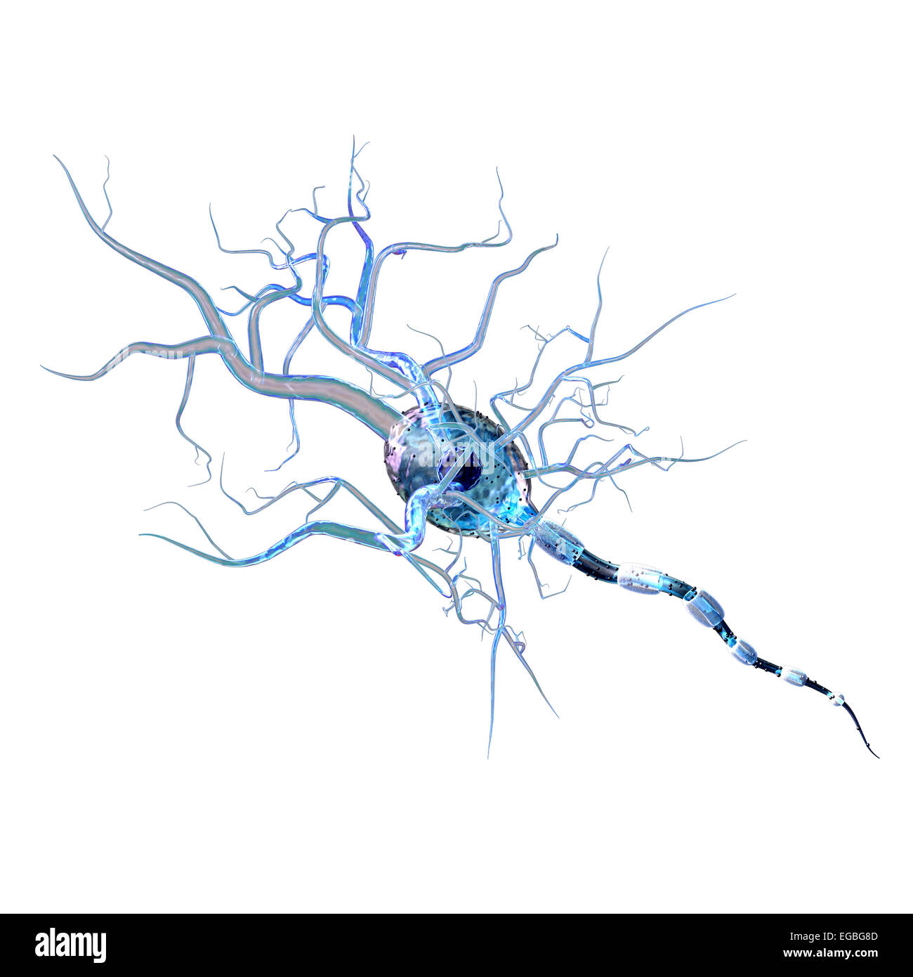 Les cellules nerveuses, concept pour les tumeurs, les maladies neurologiques et une chirurgie du cerveau. Banque D'Images