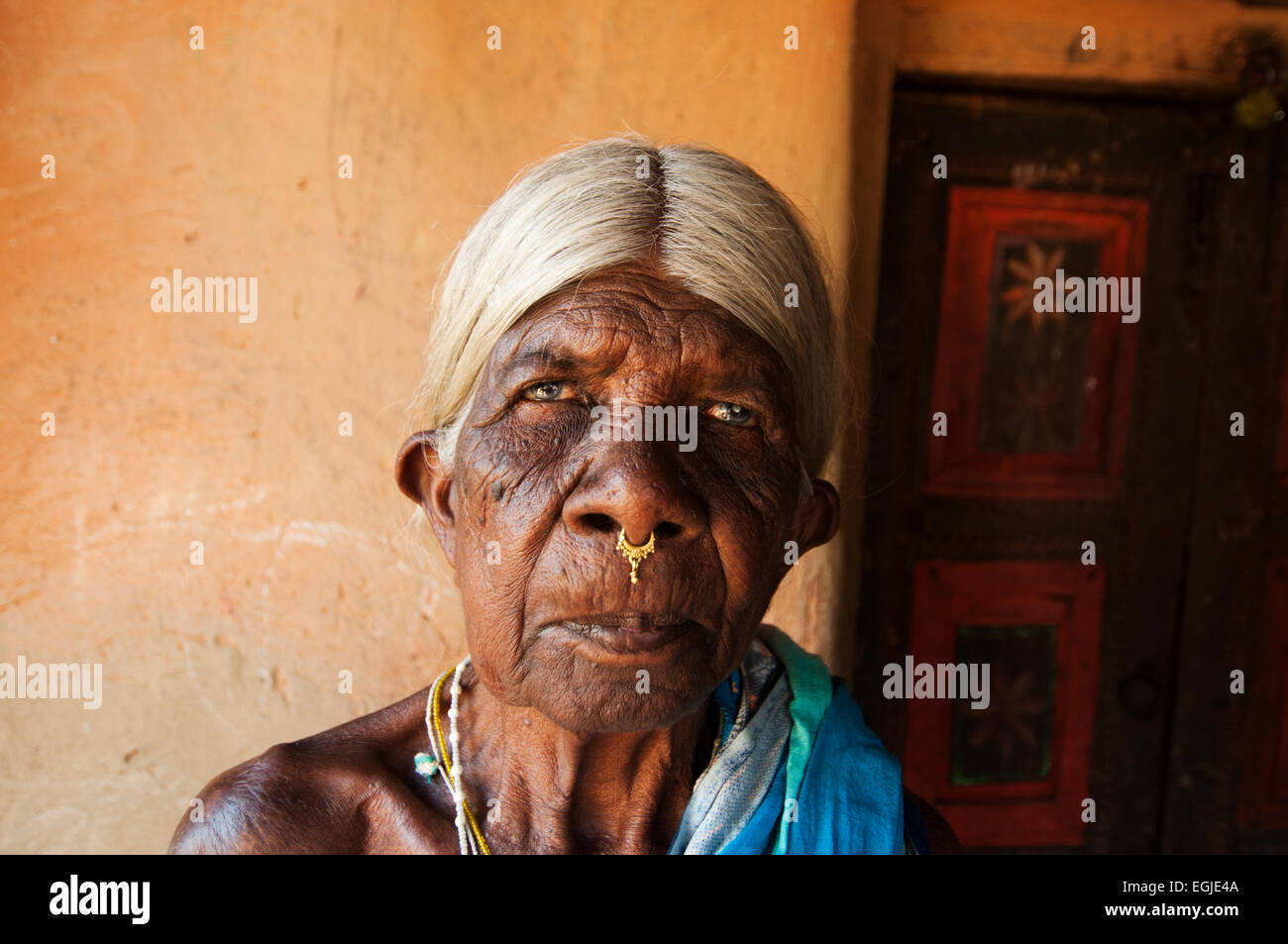 L'Inde en 2014. L'Orissa. Bwanipatna. Tilsura, cataracte patient. Banque D'Images
