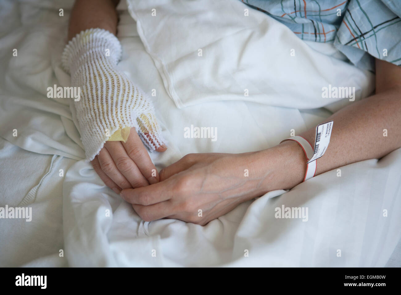 Femme brûler Patient in Hospital Bed Banque D'Images