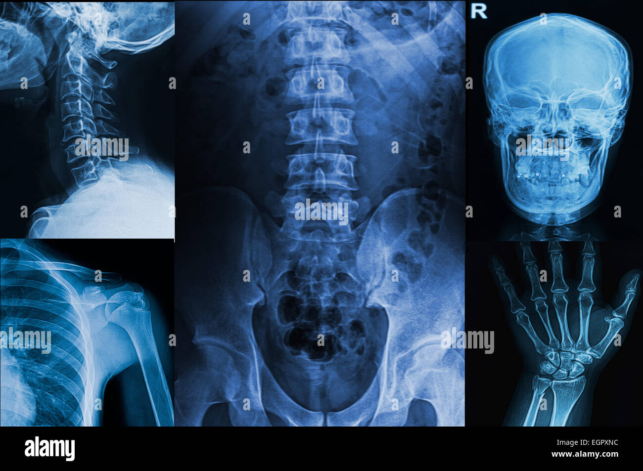 Collection x-rays de droit des droits de l',show membre supérieur des droits de l'élément corps Banque D'Images