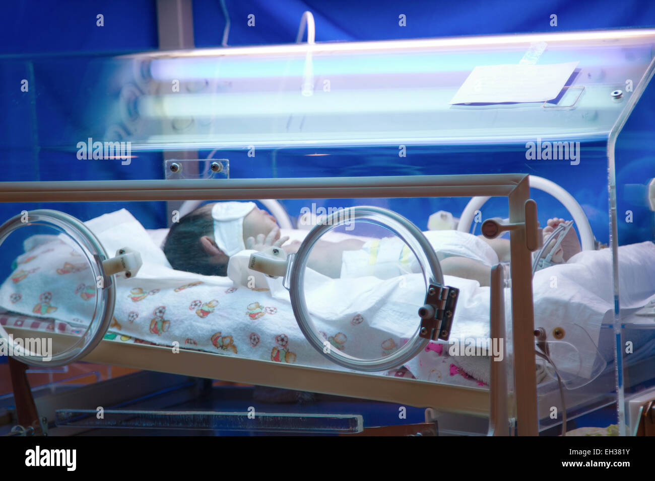 Nouveau Ne Premature En Couveuse Sous Lumiere Uv Bleu Photo Stock Alamy Nouveau Ne Premature En Couveuse Sous Lumiere Uv Bleu Photo Stock Alamy