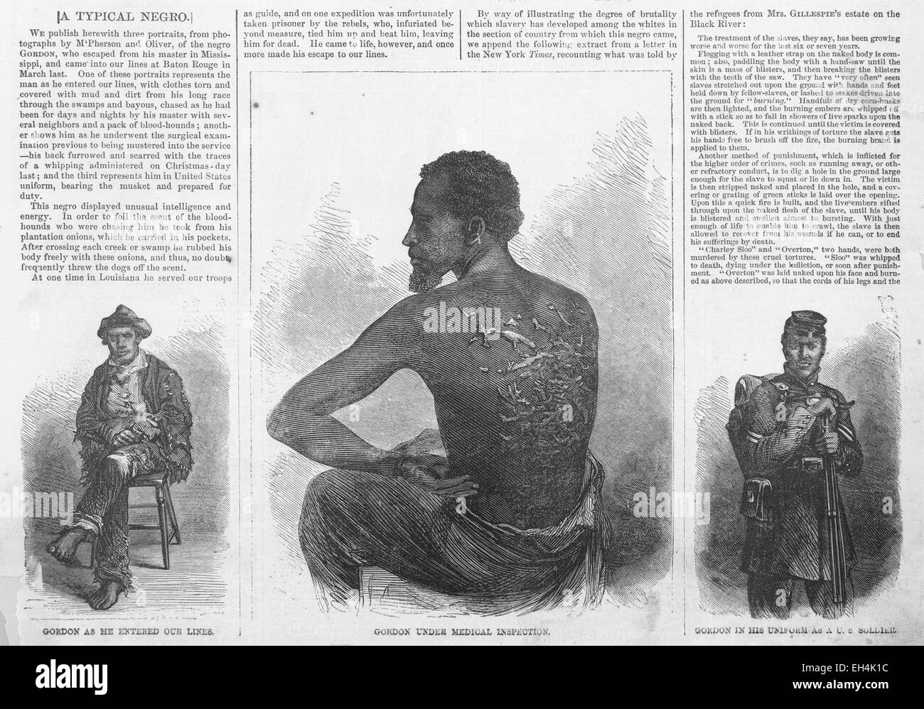 Gravure de GORDON ESCLAVE Harper's Weekly en 1863 montrant les cicatrices d'whiping Banque D'Images