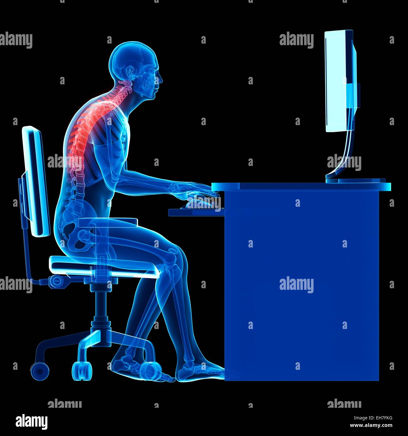 Personne assise avec les mauvaises postures Banque D'Images