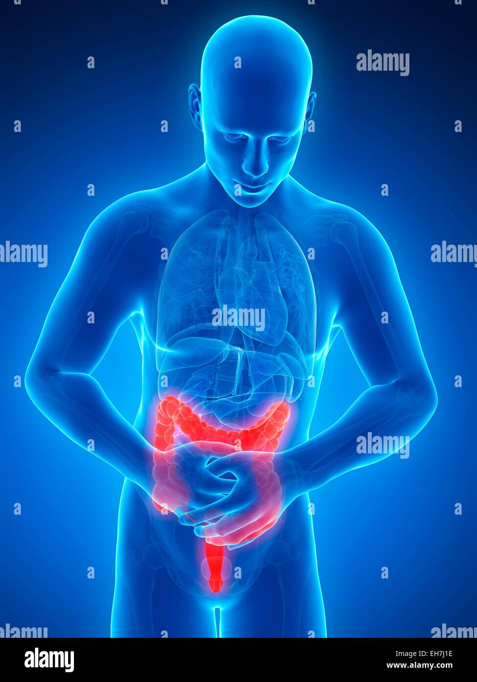 Gros intestin humain, illustration de la douleur Banque D'Images