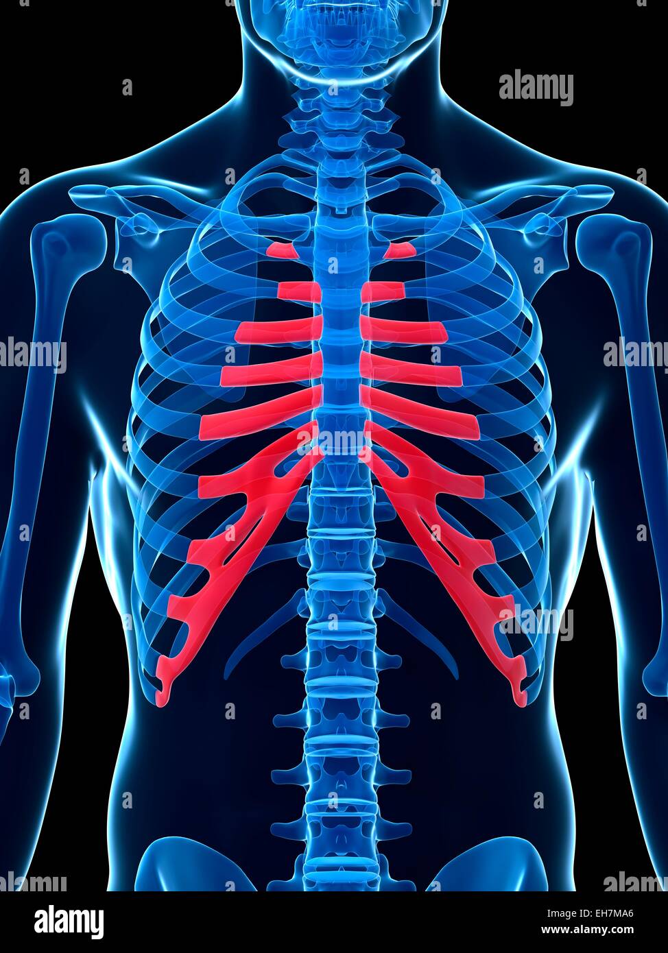 Human Rib Cartilage Banque D Image Et Photos Alamy