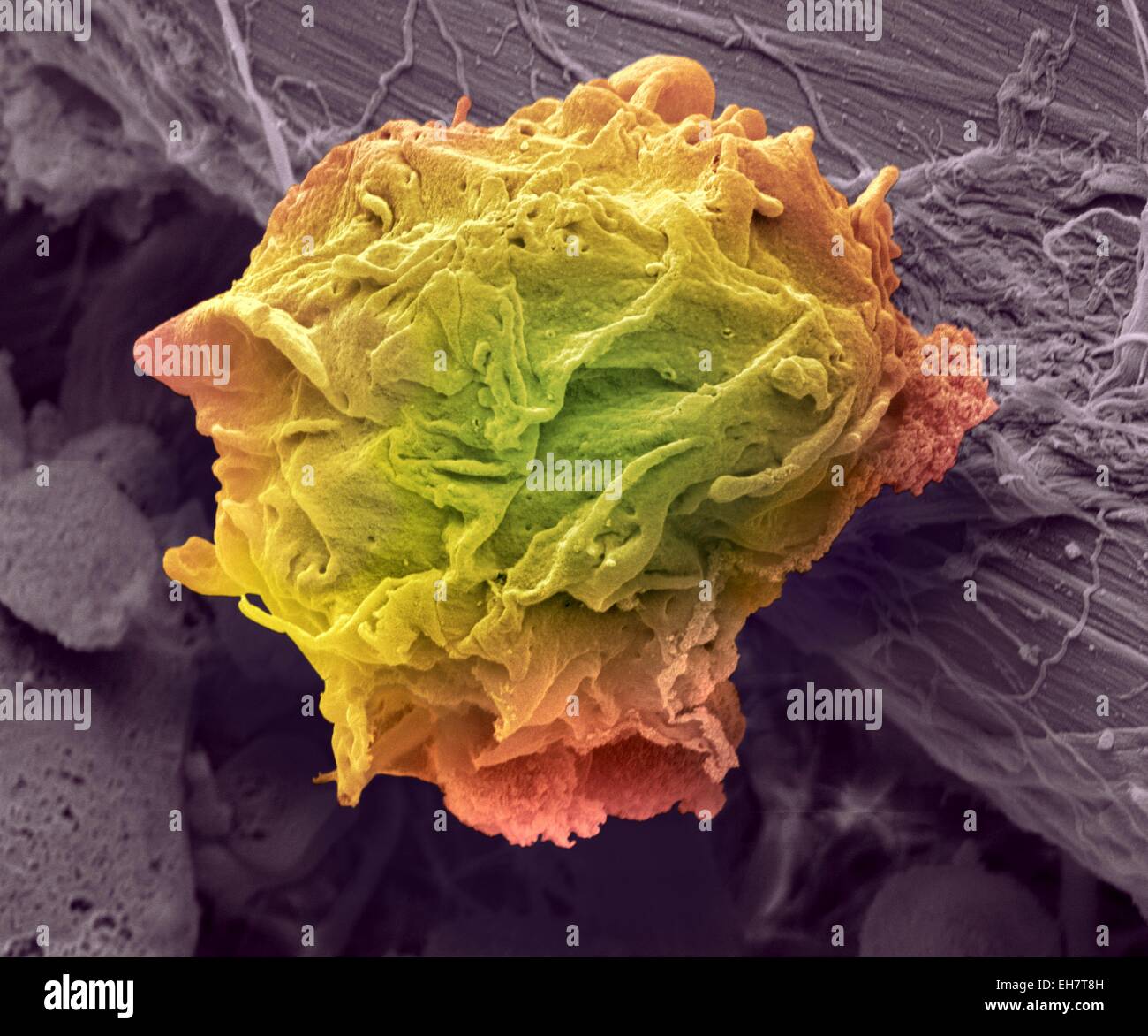 Test De Lymphome Banque Dimages Dtoures Alamy