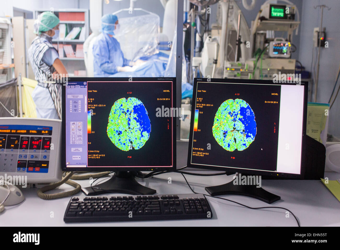 Angiographie cérébrale thrombectomie réalisée sous sur un patient avec des symptômes d'un AVC, Neuro-Vascular (VNU) CHU de Bordeaux. Banque D'Images