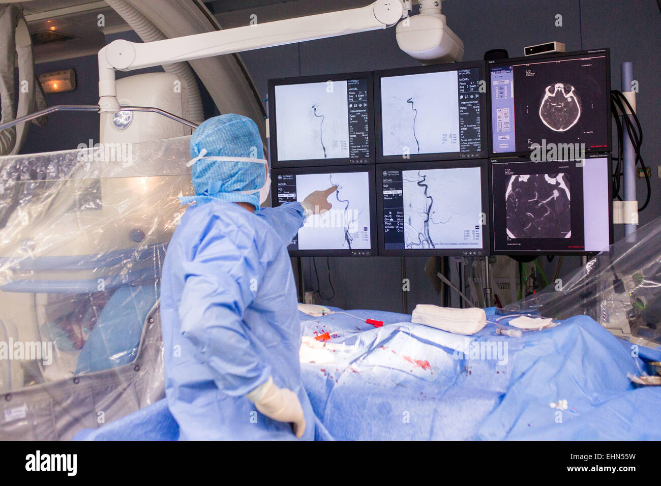 Angiographie cérébrale thrombectomie réalisée sous sur un patient avec des symptômes d'un AVC, Neuro-Vascular (VNU) CHU de Bordeaux. Banque D'Images
