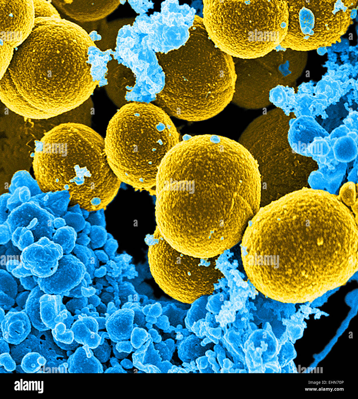 Couleur de l'analyse des électrons Microphotographie (SEM) de Staphylococcus aureus résistant à la méthicilline (SARM) bactéries. Banque D'Images