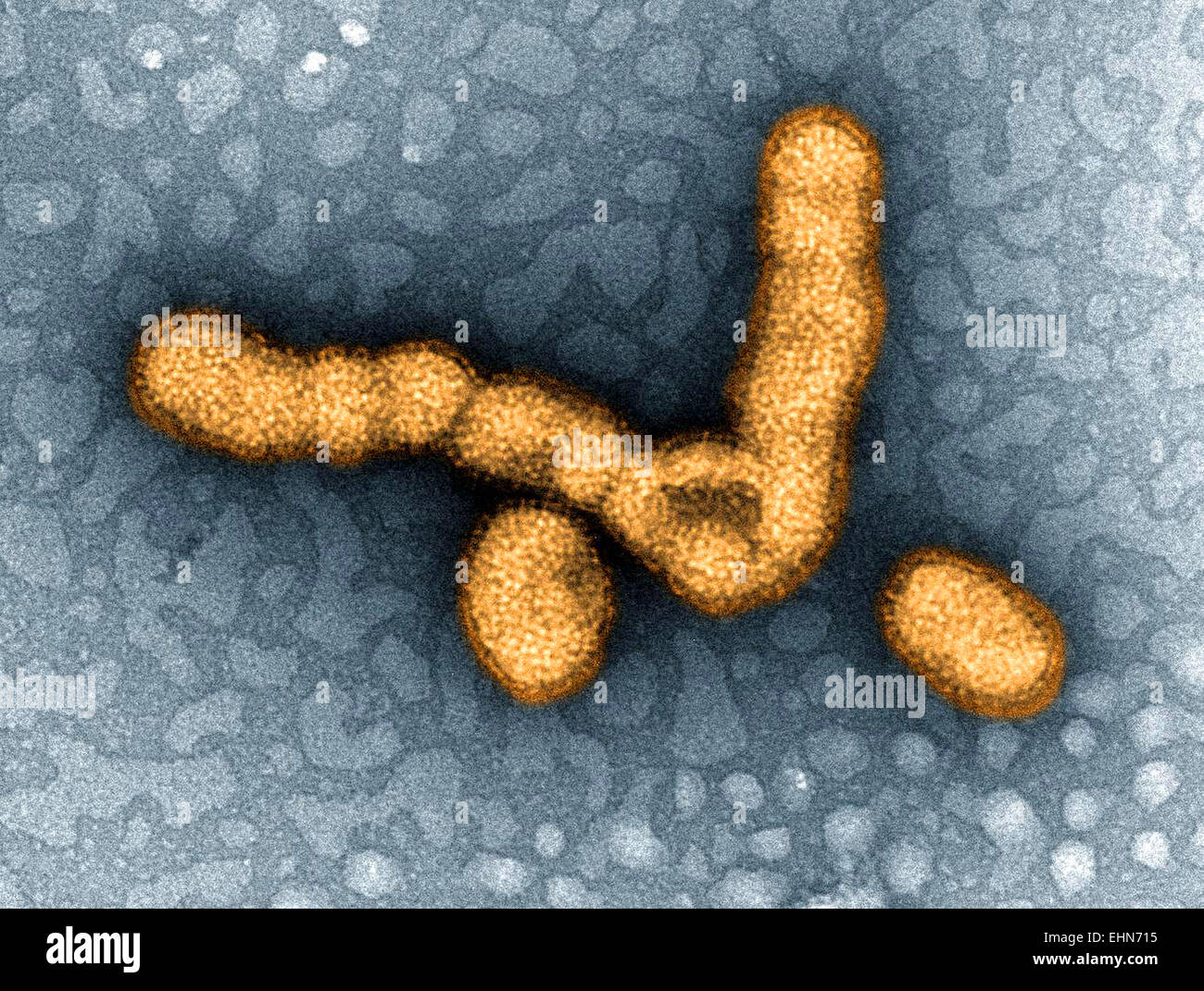 Micrographie électronique à transmission (TEM) représente le nombre de virus de la grippe H1N1 particules. Banque D'Images