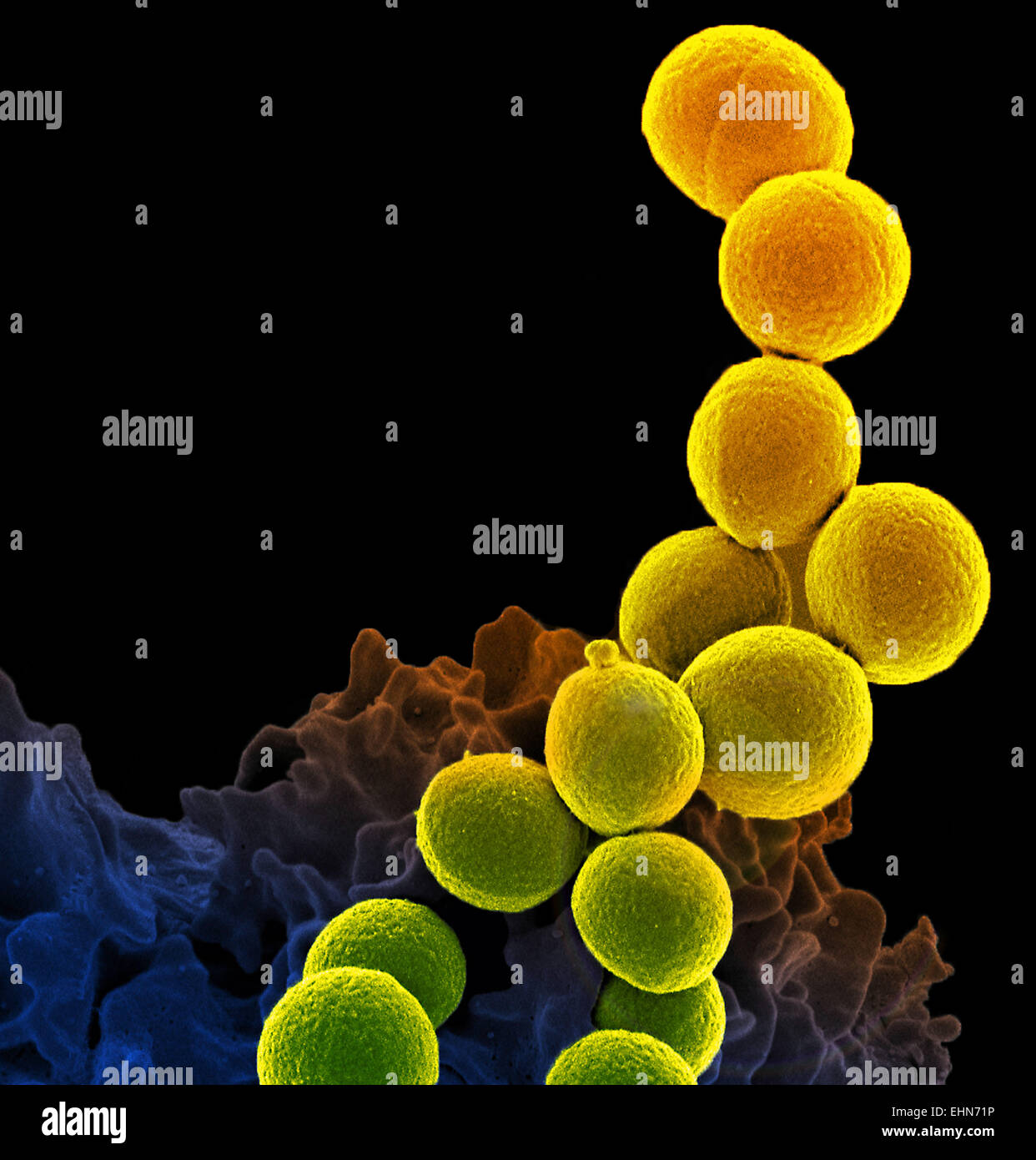 Couleur de l'analyse des électrons Microphotographie (SEM) d'un neutrophile globule blanc (en bas) d'attaquer au Staphylococcus aureus (MRSA, jaune). Banque D'Images