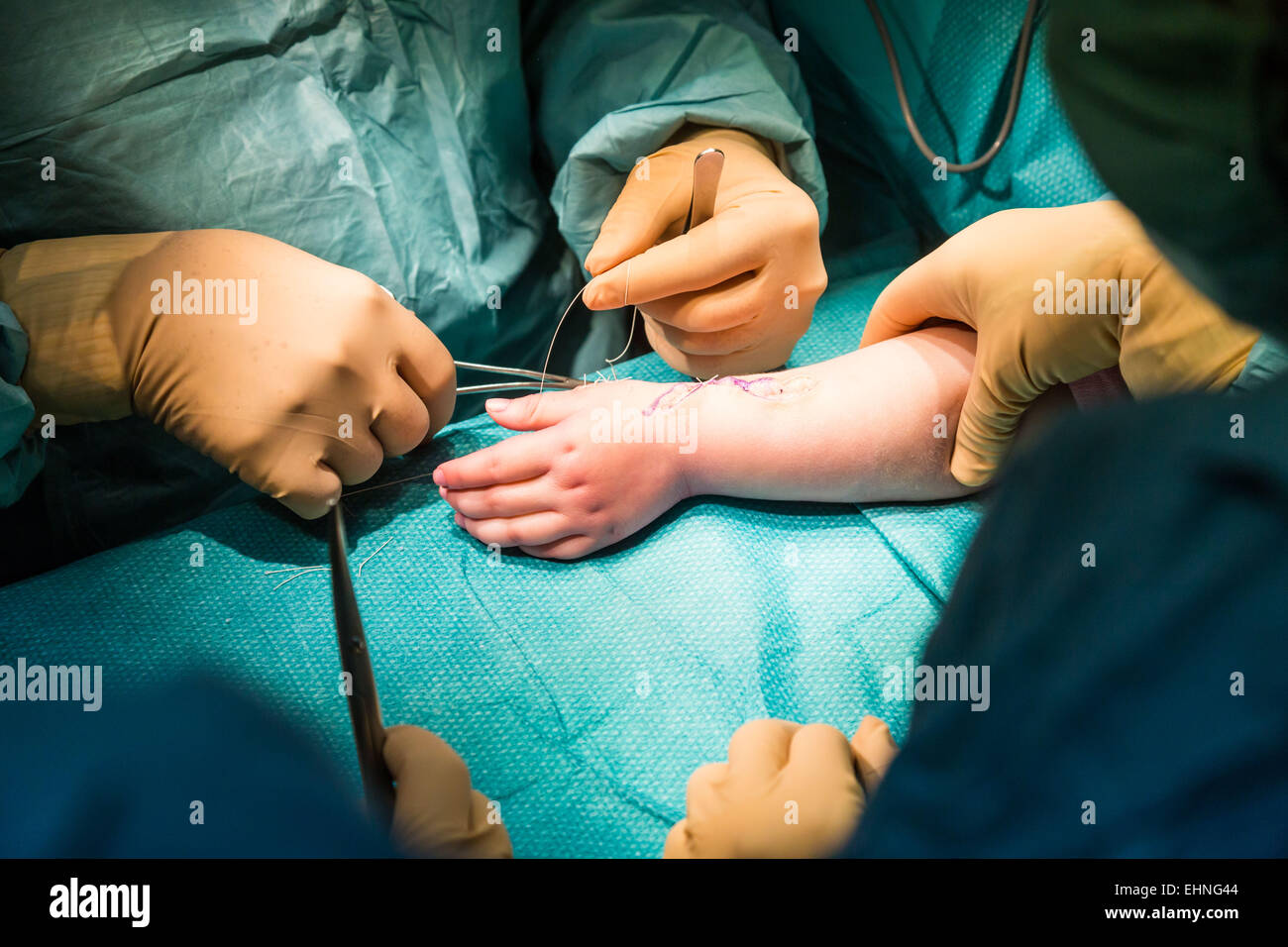 Chirurgie de la main. Banque D'Images