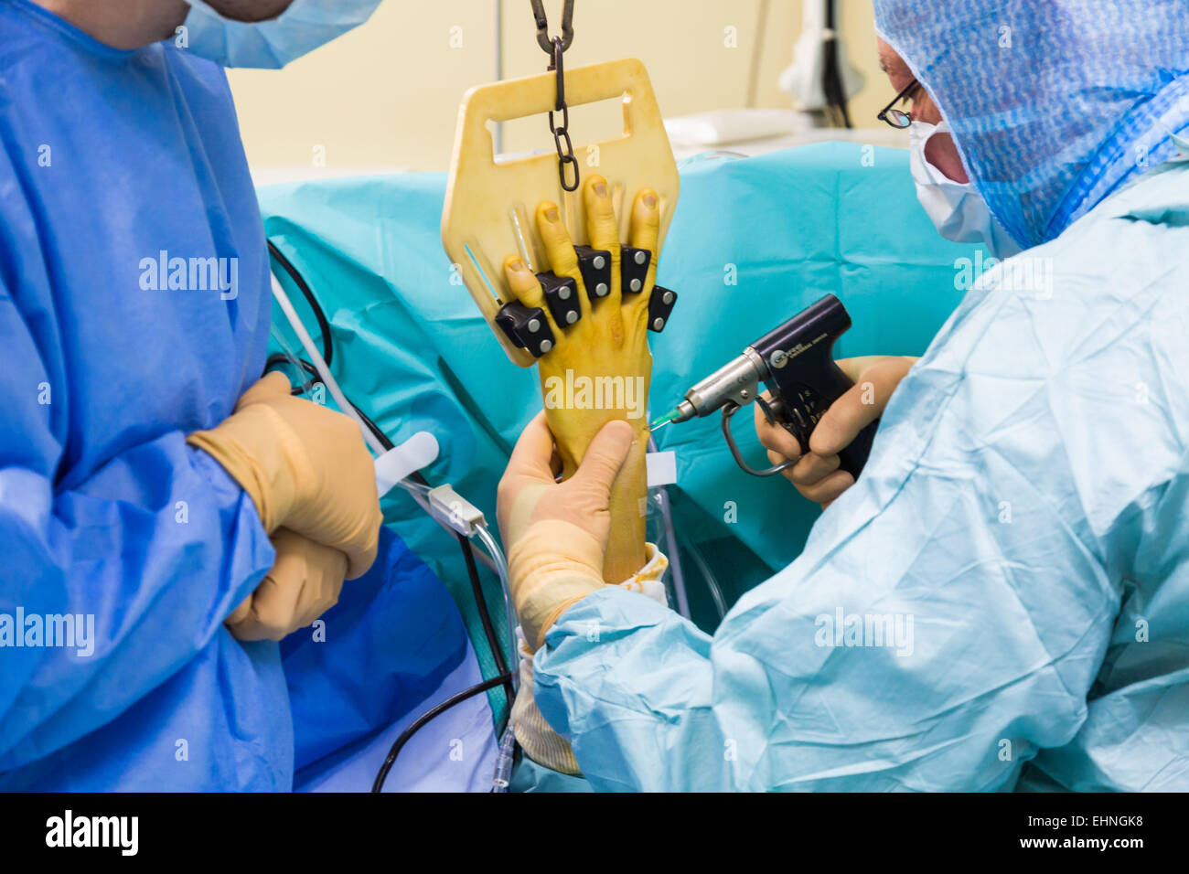 Borne mise sur une fracture au poignet de l'arthroscopie, clinique Jouvenet, Paris, France. Banque D'Images