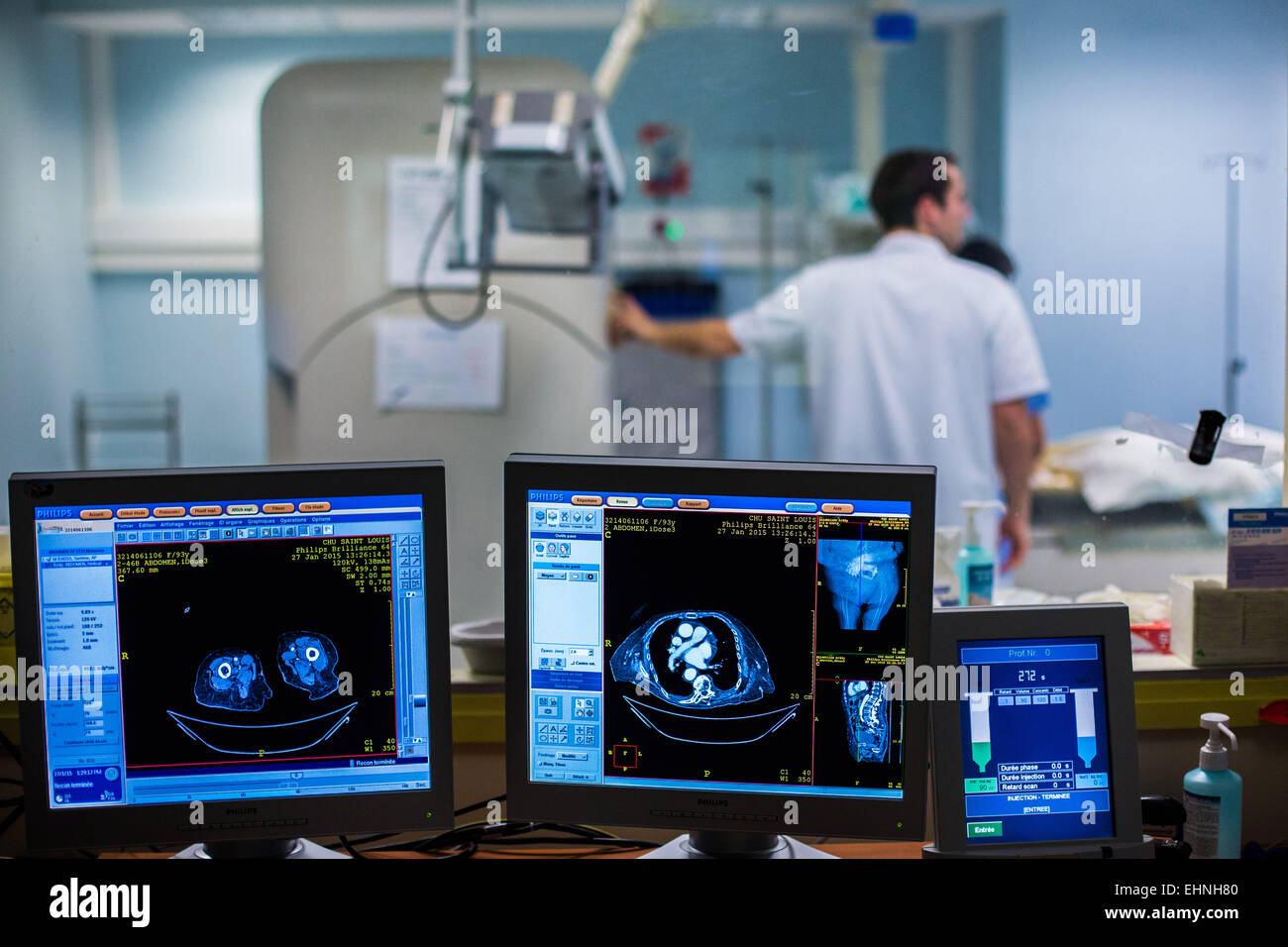 Tomodensitométrie assistée de la cryothérapie pour détruire une tumeur rénale, hôpital Saint-Louis, Paris, France. Banque D'Images