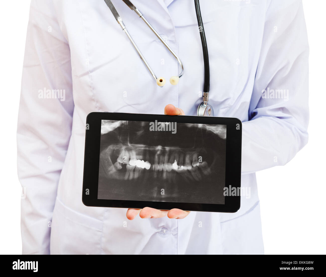 Infirmière tablet pc avec X-ray photo d'écran JAWS avec couronne dentaire isolé sur fond blanc Banque D'Images