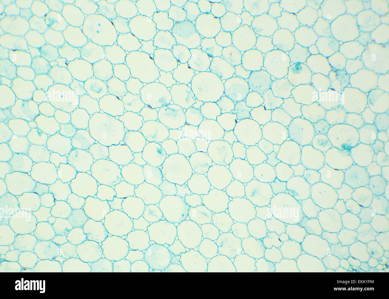 La section transversale de la tige de tournesol sous le microscope, l'Helianthus (C.S.), tige 100x Banque D'Images