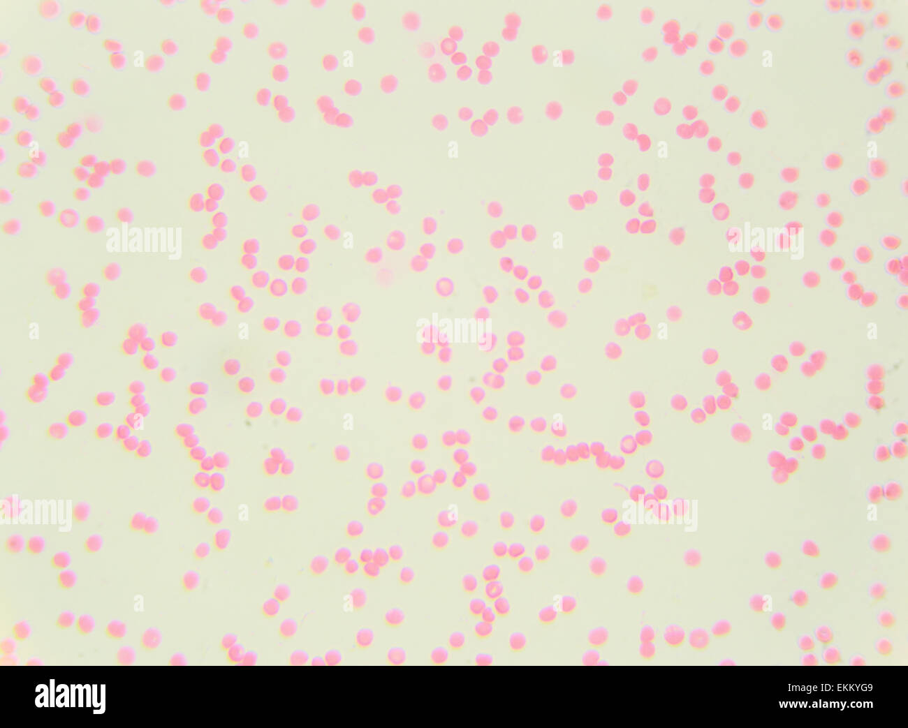 Le sang humain sous le microscope (frottis sanguin humain) 400x Banque D'Images