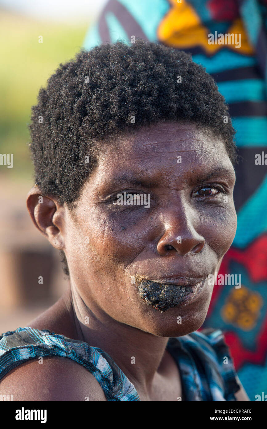 A la mi-janvier 2015, une période de trois jours de pluies excessives a unprecedneted les inondations au petit pays pauvre d'Afrique du Malawi. Il déplacé près de 250 000 personnes, a dévasté 64 000 hectares d'alnd, et tué plusieurs centaines de personnes. Cette photo montre une femme déplacée avec une tumeur cancéreuse dans le camp de réfugiés de Chiteskesa refugge camp, près de Mulanje. Banque D'Images