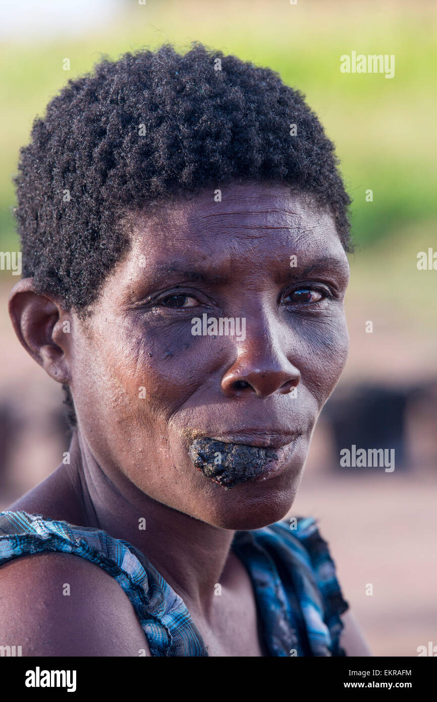 A la mi-janvier 2015, une période de trois jours de pluies excessives a unprecedneted les inondations au petit pays pauvre d'Afrique du Malawi. Il déplacé près de 250 000 personnes, a dévasté 64 000 hectares d'alnd, et tué plusieurs centaines de personnes. Cette photo montre une femme déplacée avec une tumeur cancéreuse dans le camp de réfugiés de Chiteskesa refugge camp, près de Mulanje. Banque D'Images
