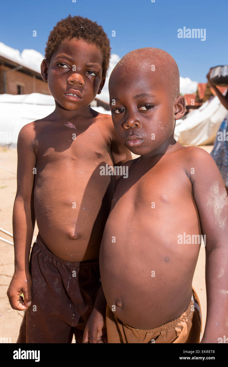 A La Mi Janvier 15 Une Periode De Trois Jours De Pluies Excessives Portees Les Inondations Sans Precedent Au Petit Pays Pauvre D Afrique Du Malawi Il Deplace Pres De 250 000 Personnes A