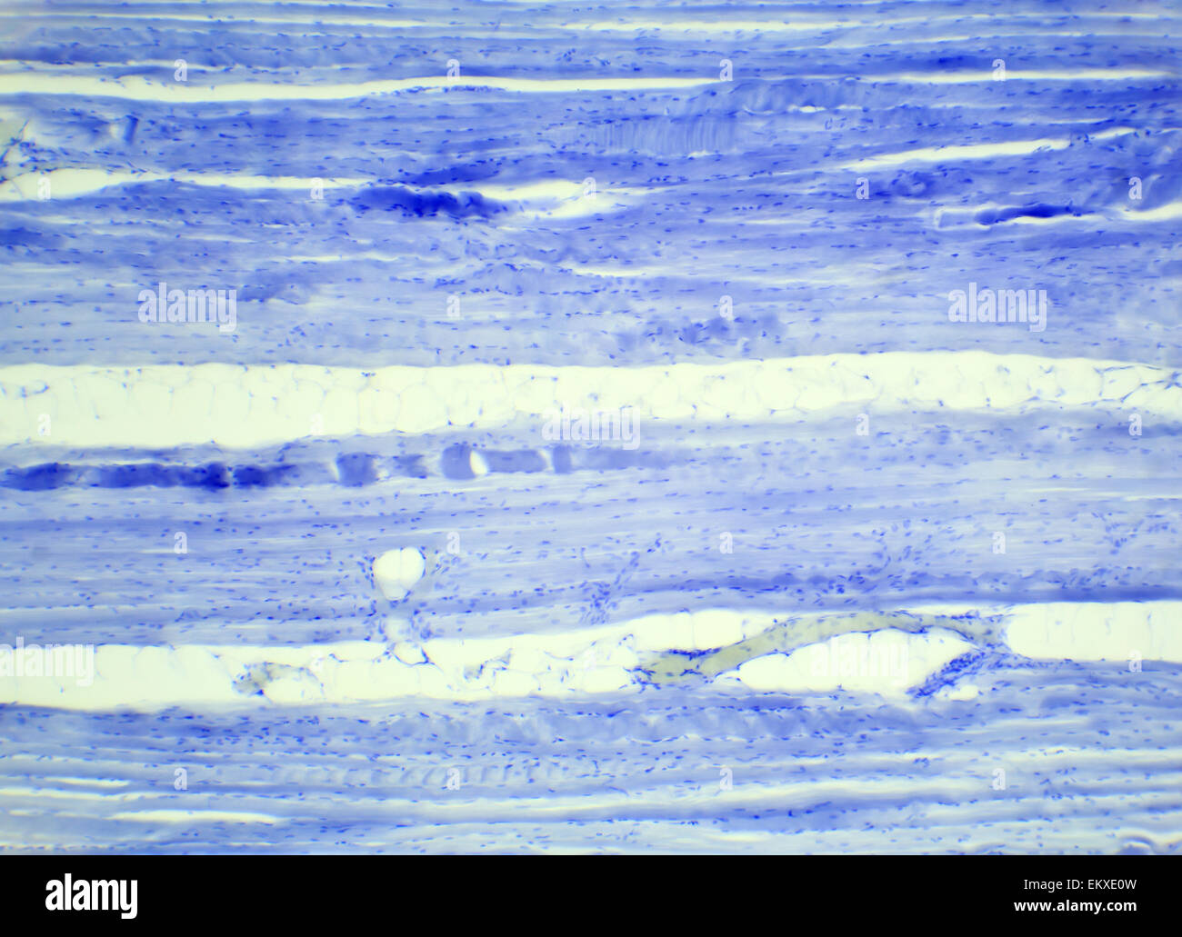 Le tissu musculaire squelettique section longitudinale sous un microscope, muscle squelettique L.S., 400x Banque D'Images