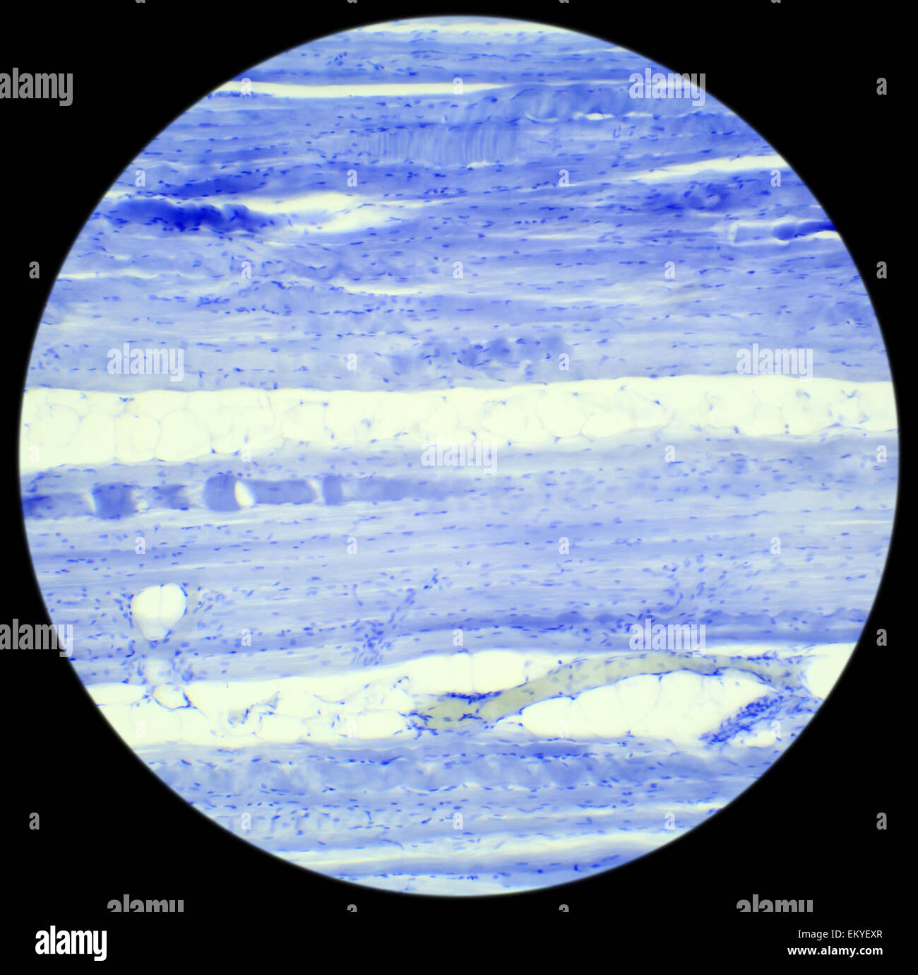 Le tissu musculaire squelettique section longitudinale sous un microscope, muscle squelettique L.S., 400x Banque D'Images