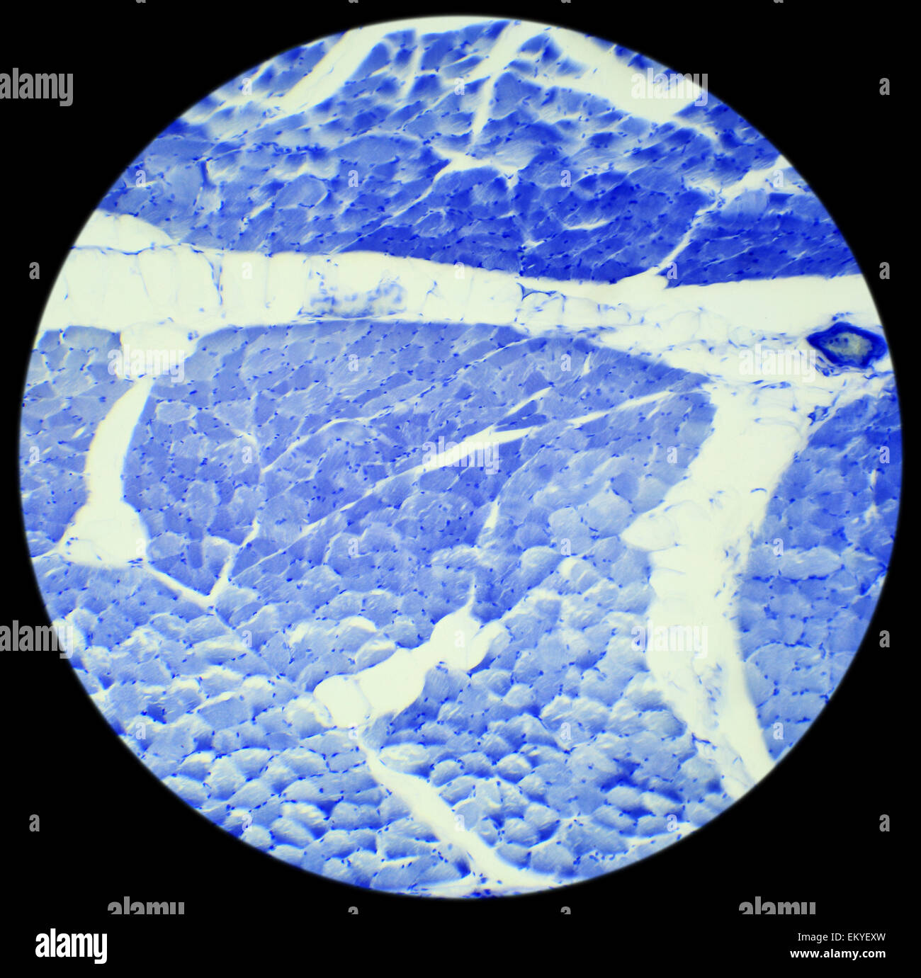 Le taquina le muscle lisse préparation sous un microscope, muscle lisse W.M., 400x Banque D'Images
