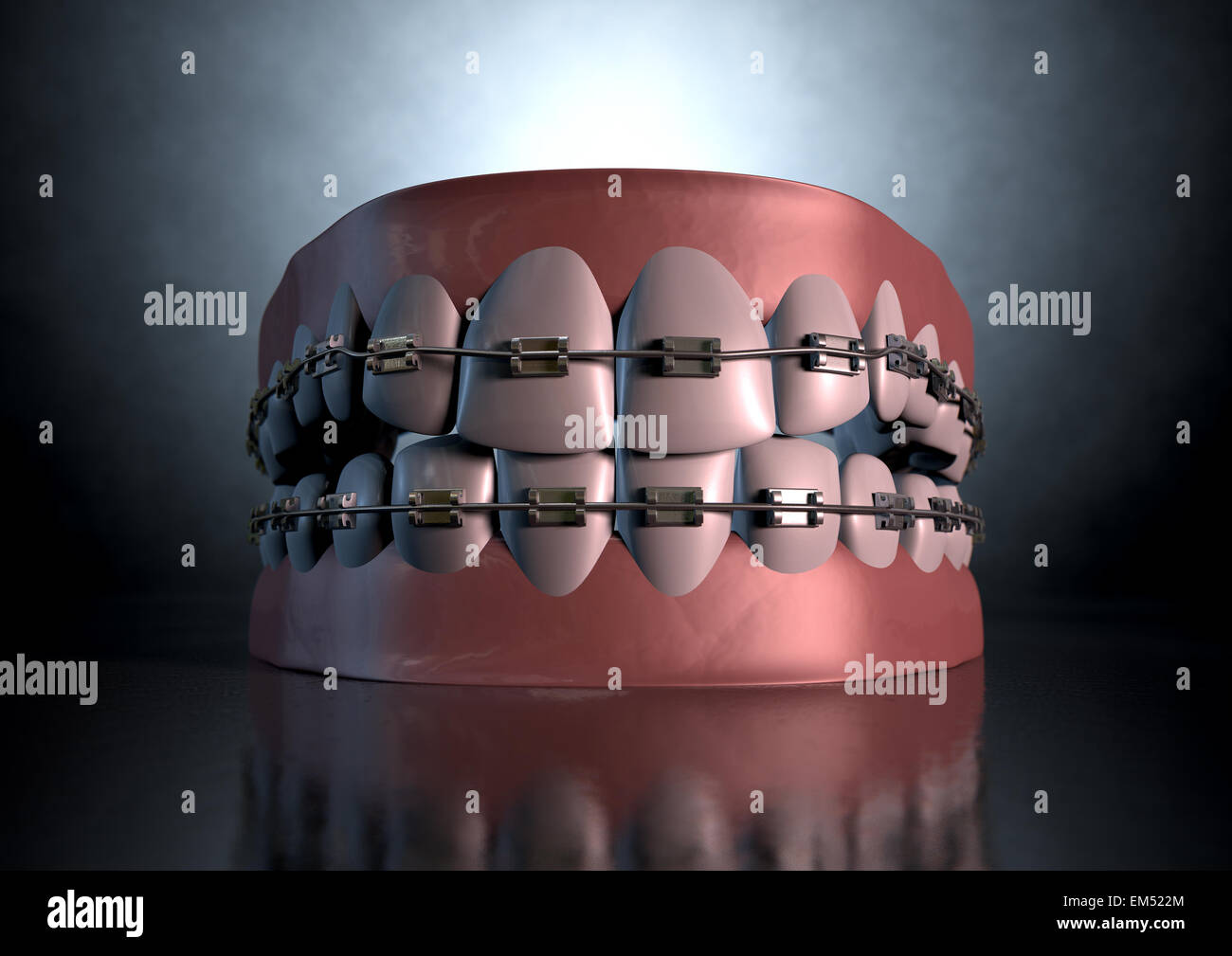 Une sinistre représentation spectaculaire de supérieur et inférieur séparés ensembles de dents humaines à bretelles qui leur sont appliquées sur un étrange sombre spotl Banque D'Images