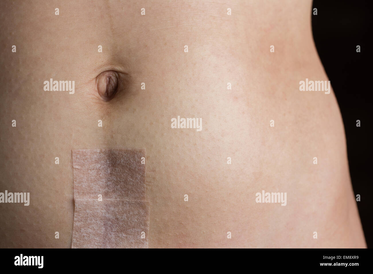 Coupure D Estomac Banque De Photographies Et D Images A Haute Resolution Alamy