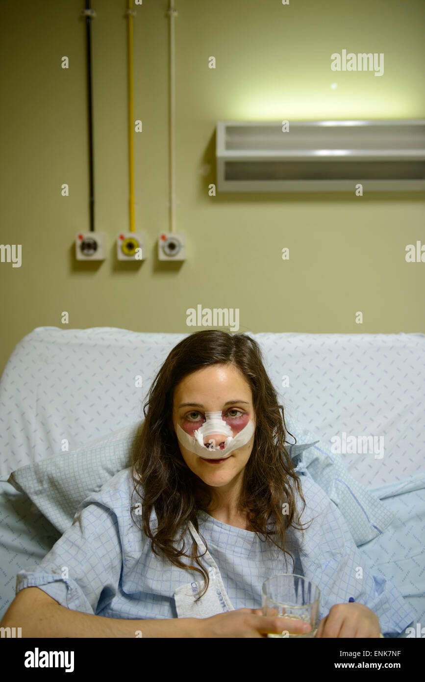 Jeune femme avec des bandages sur le visage pendant qu'ils se remettent d'un travail de nez (rhinoplastie) sur un lit d'hôpital Banque D'Images