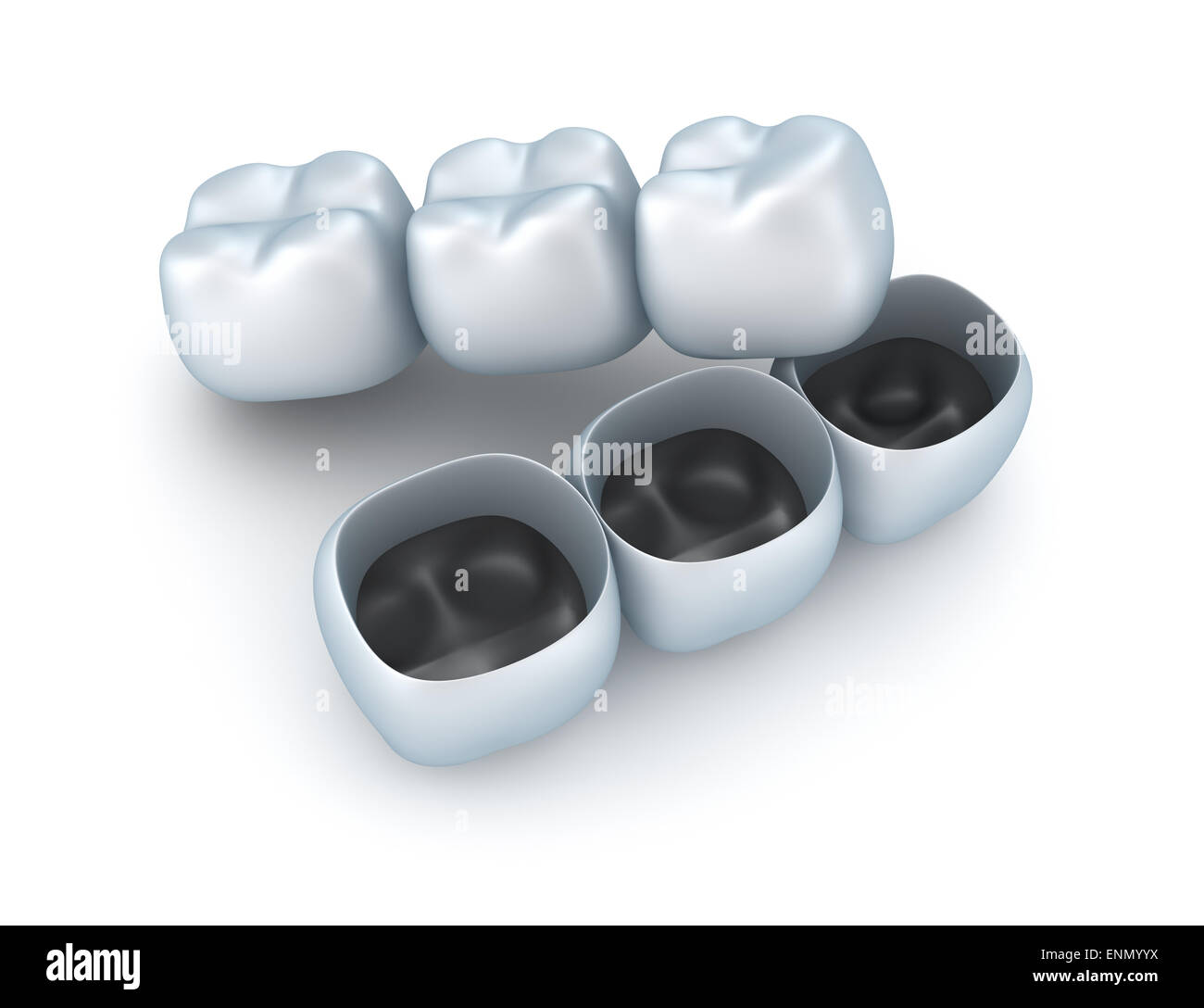 Dent artificielle de couronnes. Banque D'Images